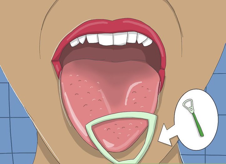 Most of the bacteria that causes bad breath is on the back of your tongue